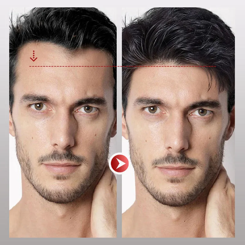 Best Seller 40%OFF Easy and Stylish For Successful Businessmen Men's Forehead Bangs Wig Patch